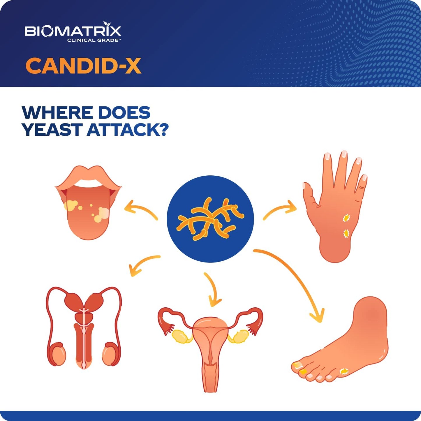 Candid-X (Candida/Yeast Cleanse) by BioMatrix